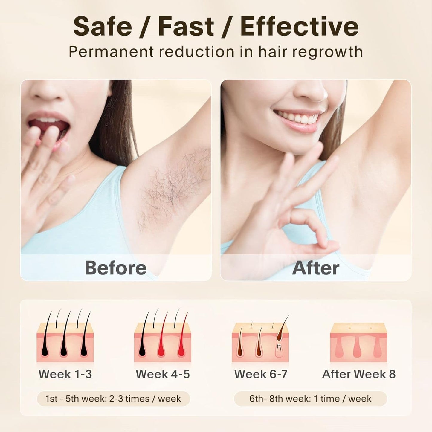 IPL Hair Removal Device for Women and Men 999999 Flashes Permanent Hair Remover for Face and Body At Home