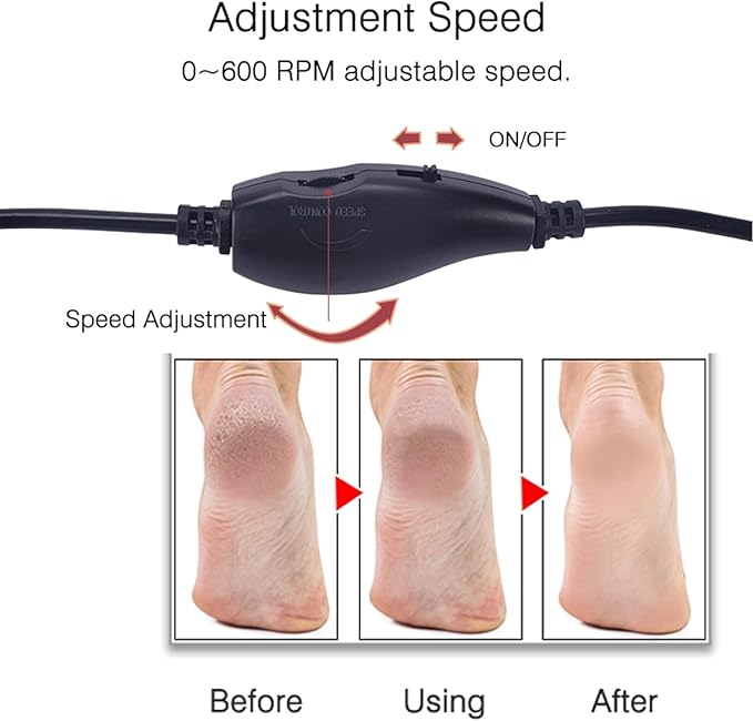 Upgraded Electric Callus Remover (Speed Adjustable) with 60pcs Replacement Sandpaper Discs, Professional Pedicure Foot File Sander for Men Women Dead Cracked Hard Dry Skin, FCR-2 Black