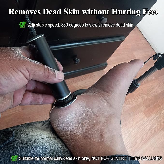 Upgraded Electric Callus Remover (Speed Adjustable) with 60pcs Replacement Sandpaper Discs, Professional Pedicure Foot File Sander for Men Women Dead Cracked Hard Dry Skin, FCR-2 Black